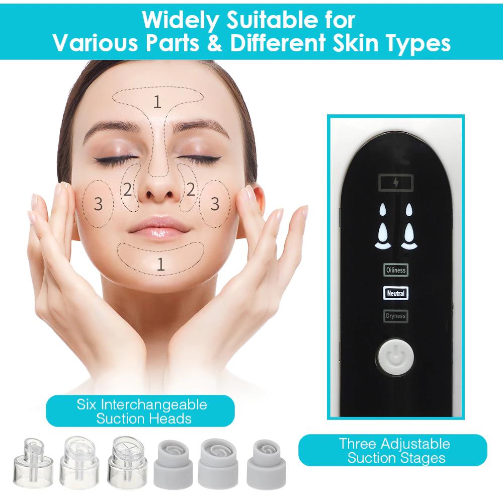 Electric Black Head Remover