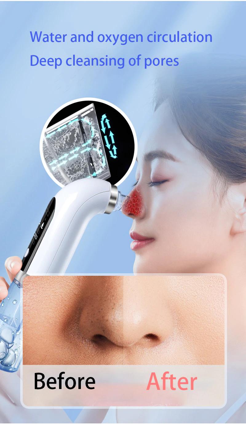 Electric Black Head Remover