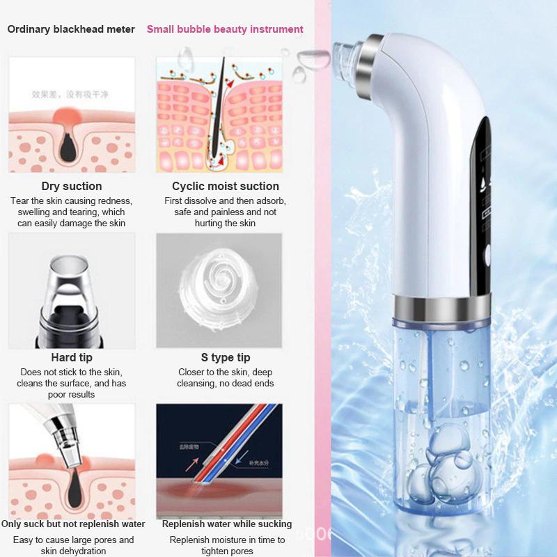 Electric Black Head Remover