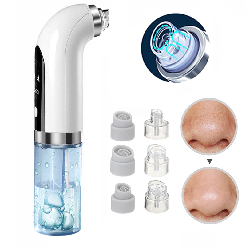 Electric Black Head Remover